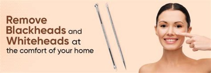 blackhead and whitehead removal