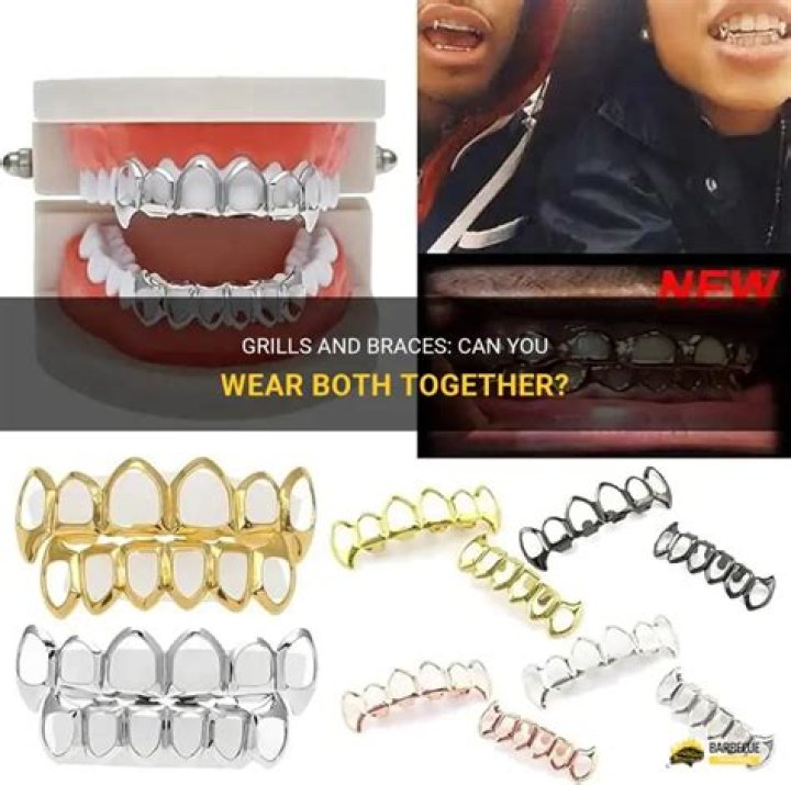 Can grills go over braces