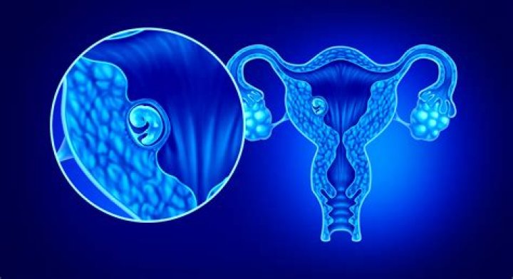 Can you dislodge implanted embryo