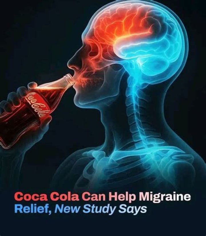 Coke Migraine Relief Coke Migraine Relief