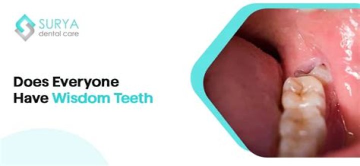 Does everyone have wisdom teeth?