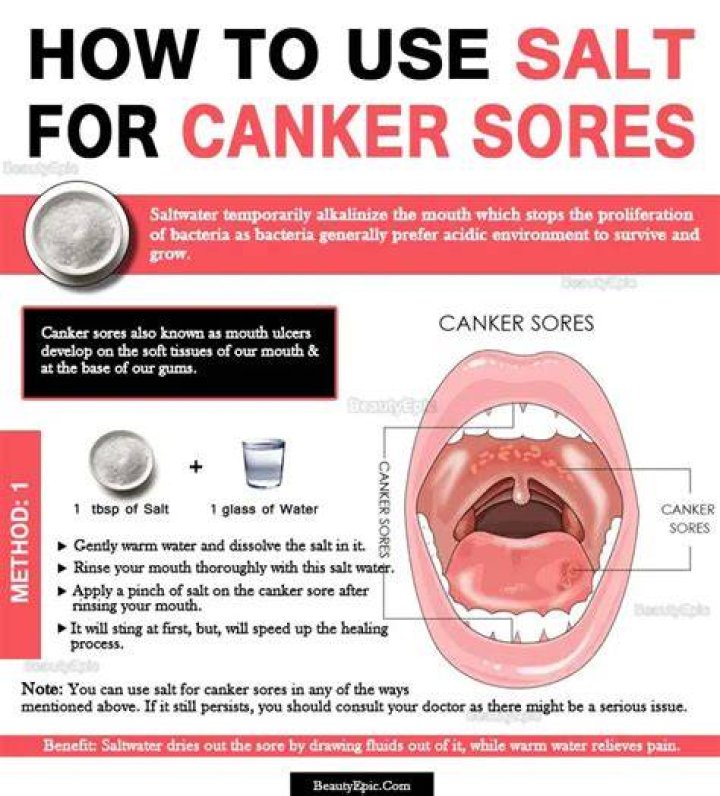 Salt On Canker Sore Salt On Canker Sore