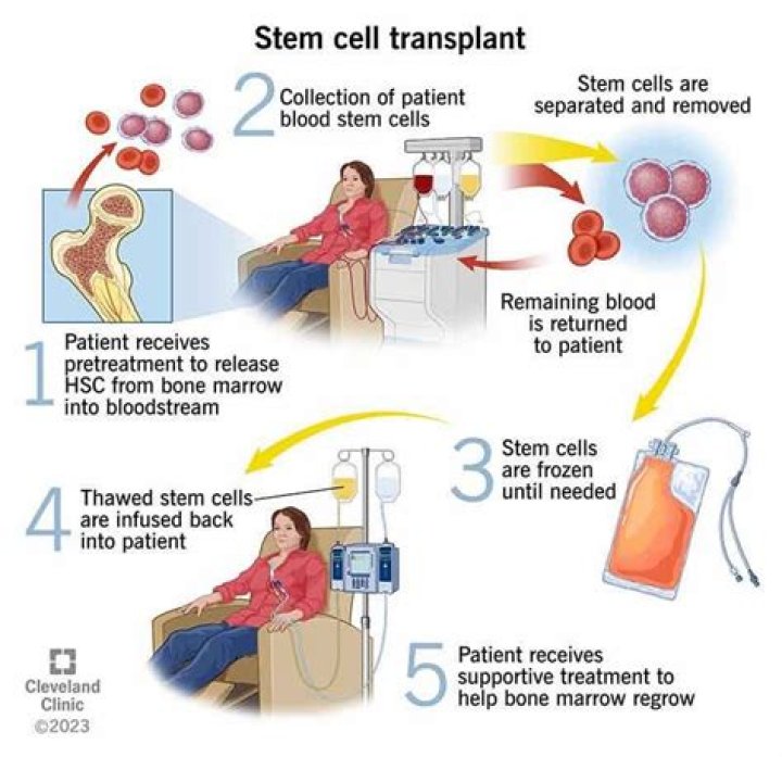 What Is Bmt - How To Discuss